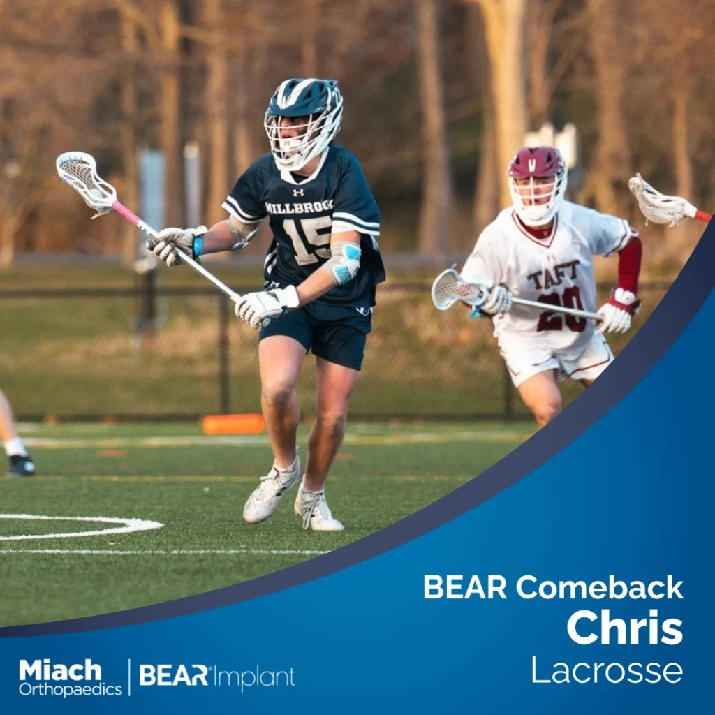 Preview photo of Chris Berardis playing lacrosse on a field